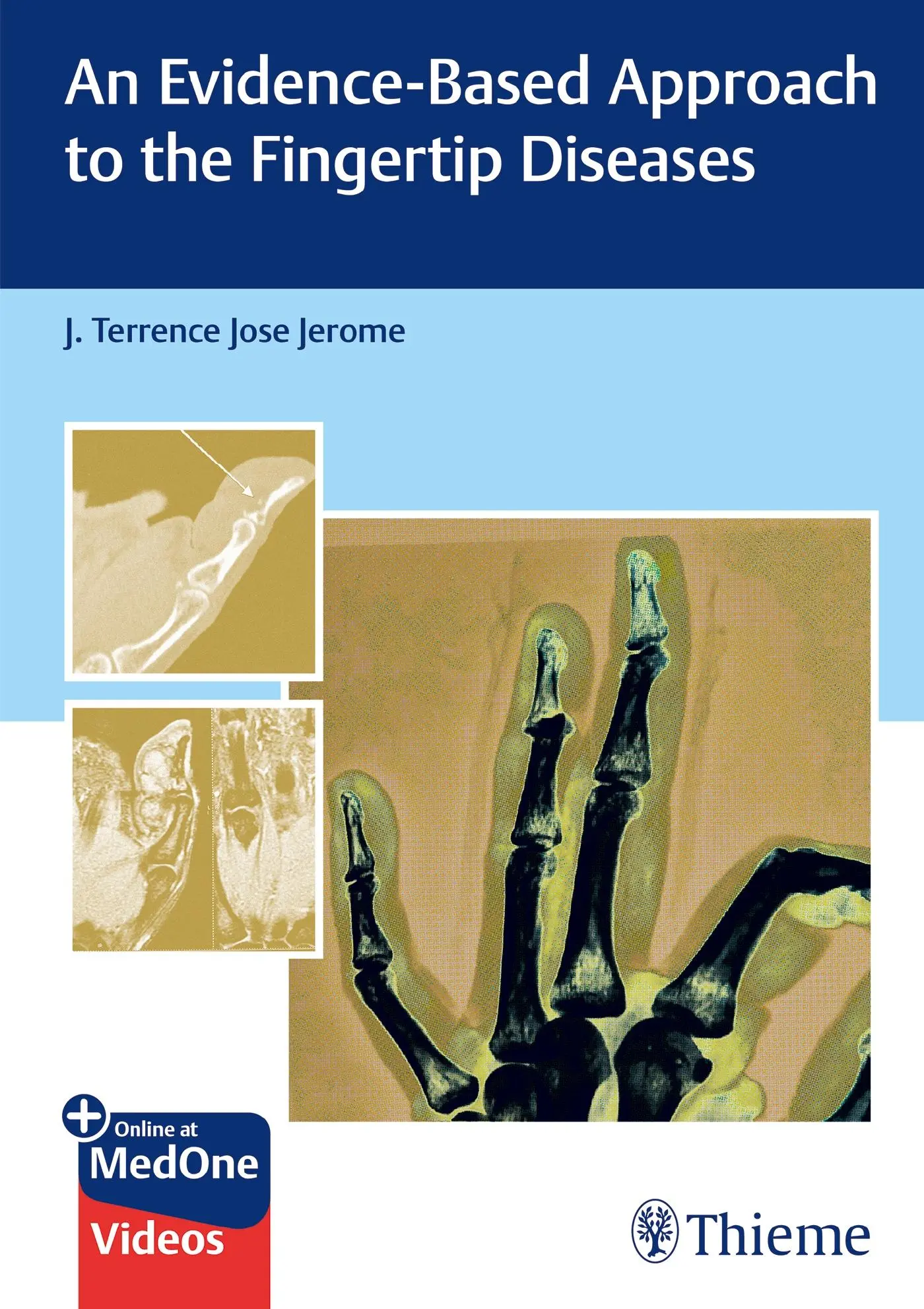 Cover: 9789392819360 | An Evidence-Based Approach to the Fingertip Diseases | Jerome | Buch