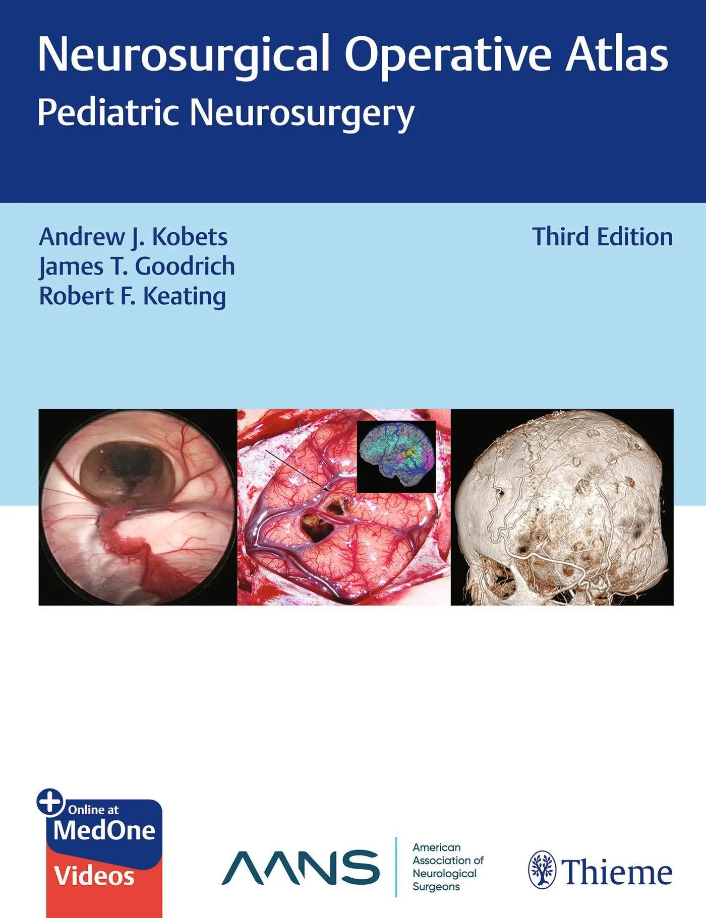Cover: 9781626231061 | Neurosurgical Operative Atlas: Pediatric Neurosurgery | Kobets (u. a.)