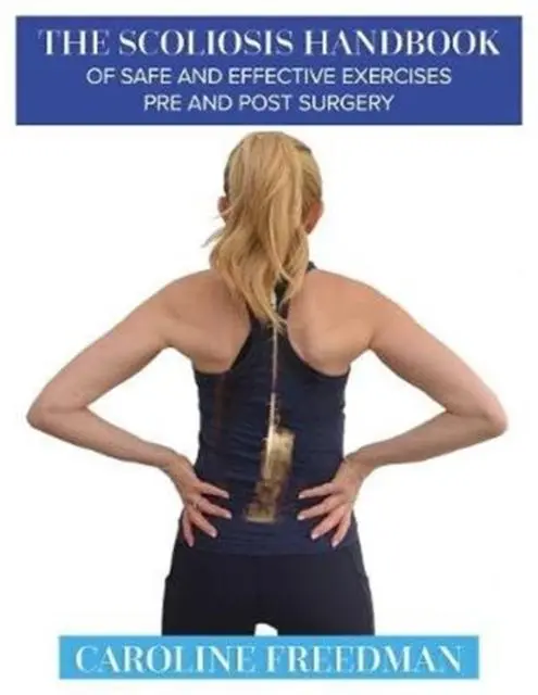 Cover: 9781781611661 | The Scoliosis Handbook of Safe and Effective Exercises Pre and Post...