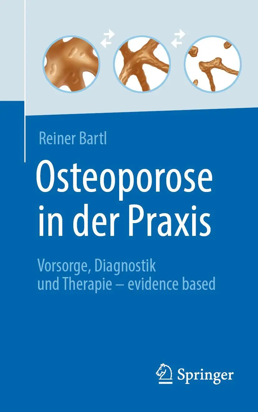 Cover: 9783662642061 | Osteoporose in der Praxis | Reiner Bartl | Taschenbuch | VIII | 2022
