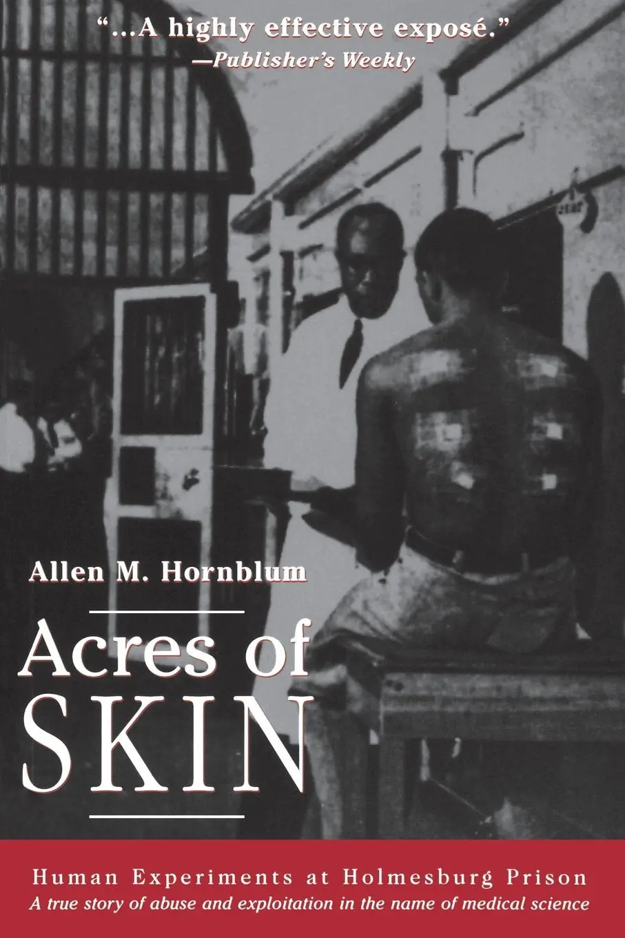 Cover: 9780415923361 | Acres of Skin | Human Experiments at Holmesburg Prison | Hornblum Cover: 9780415923361 | Acres of Skin | Human Experiments at Holmesburg Prison | Hornblum