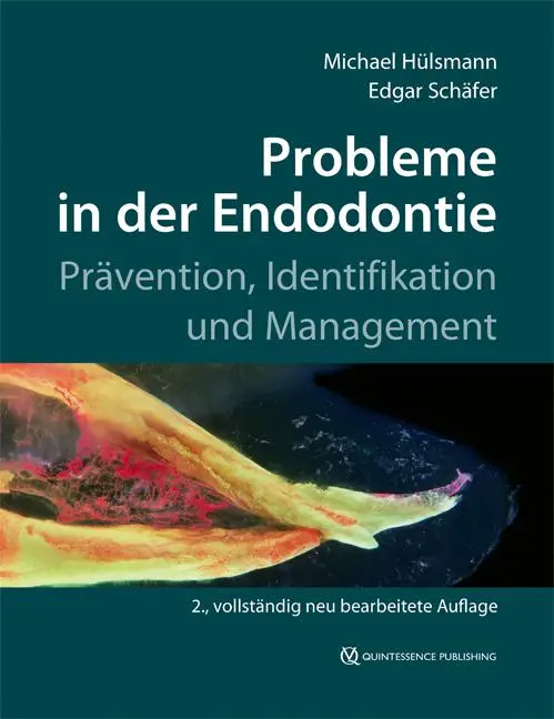 Cover: 9783868673661 | Probleme in der Endodontie | Prävention, Identifikation und Management