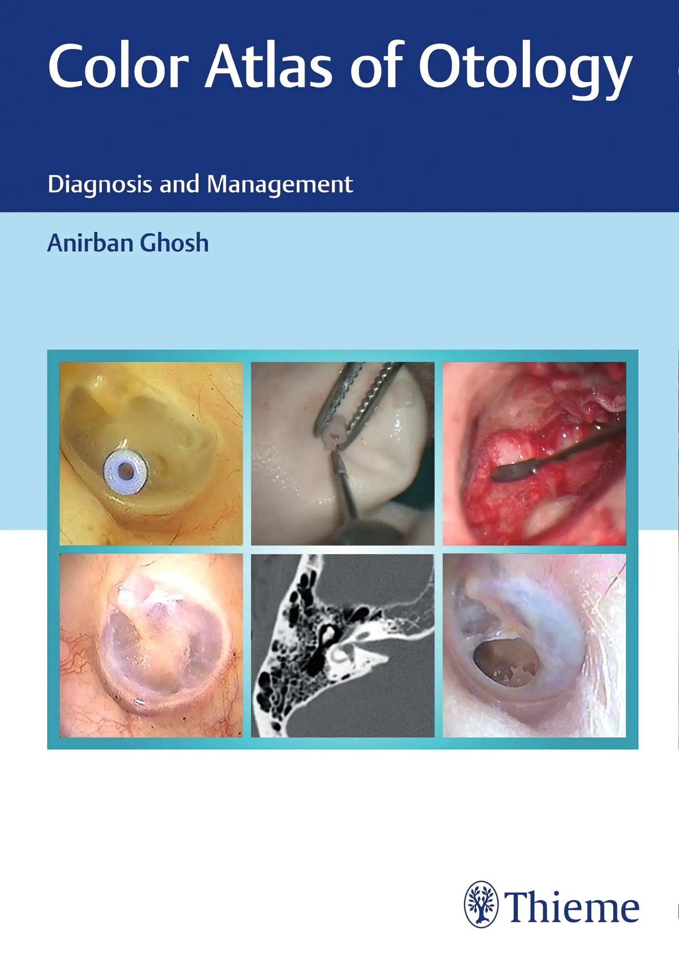 Cover: 9789390553761 | Color Atlas of Otology | Diagnosis and Management | Anirban Ghosh