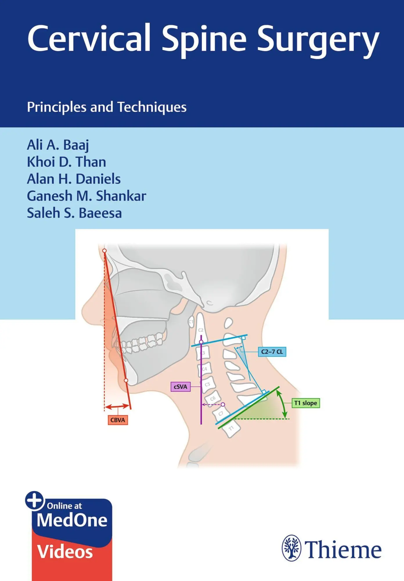 Cover: 9781684206261 | Cervical Spine Surgery | Principles and Techniques | Daniels (u. a.)