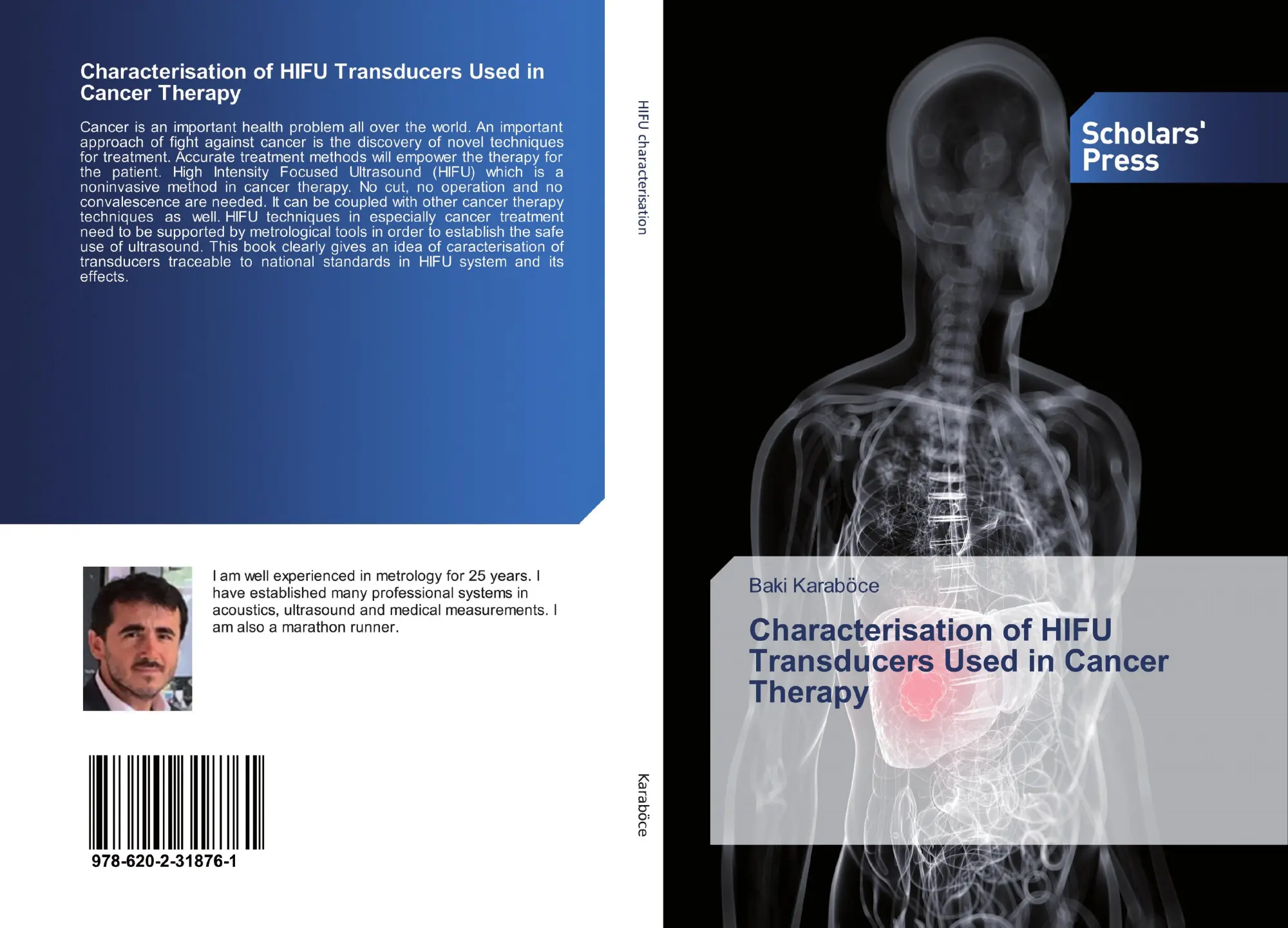 Cover: 9786202318761 | Characterisation of HIFU Transducers Used in Cancer Therapy | Karaböce