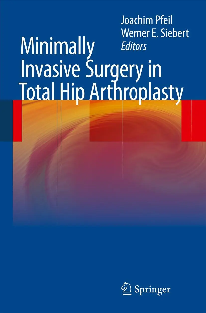 Cover: 9783662518861 | Minimally Invasive Surgery in Total Hip Arthroplasty | Siebert (u. a.)
