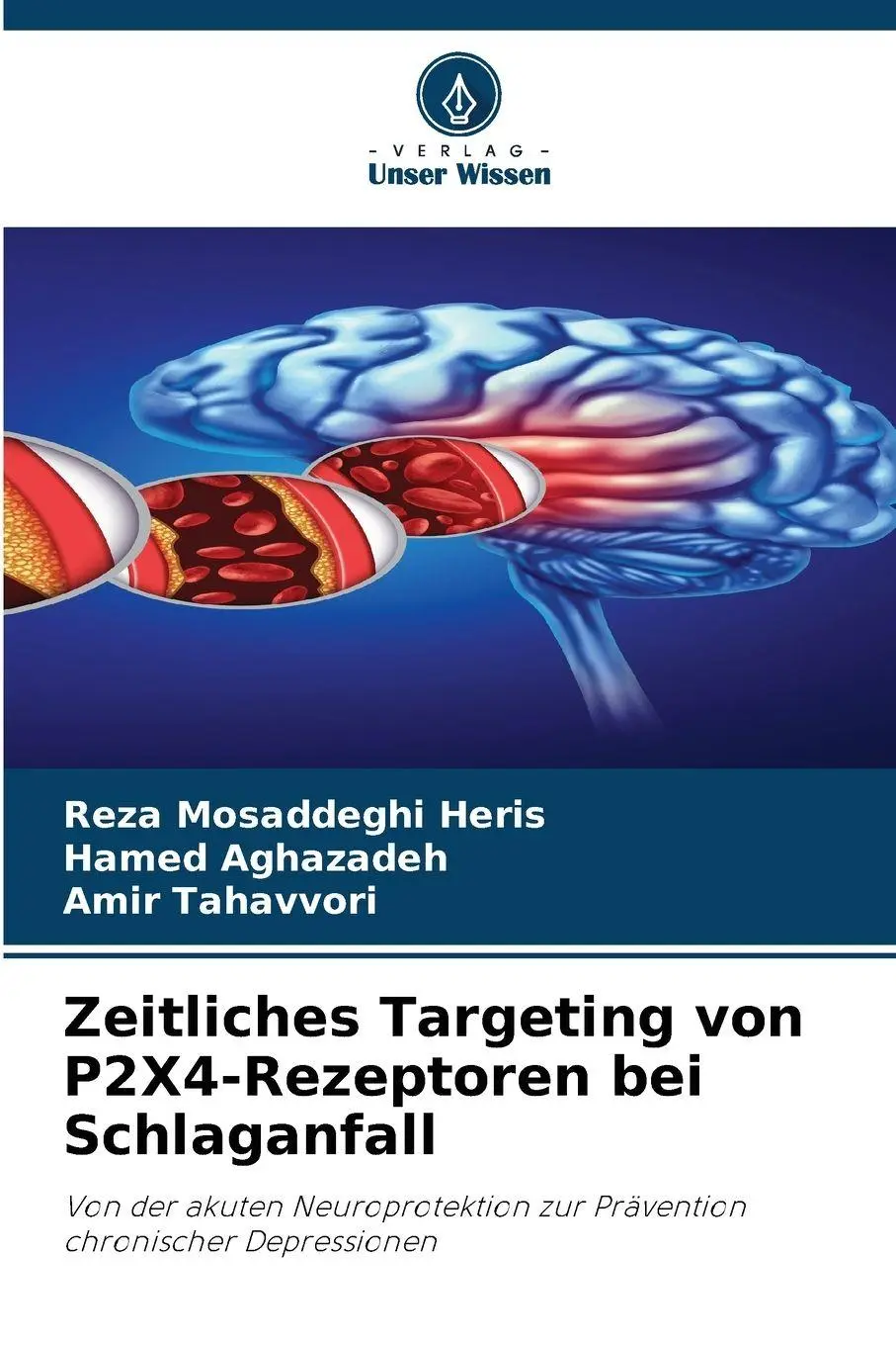 Cover: 9786209360862 | Zeitliches Targeting von P2X4-Rezeptoren bei Schlaganfall | Buch