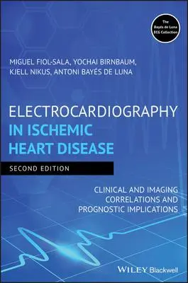Cover: 9781119422662 | Electrocardiography in Ischemic Heart Disease | Fiol-Sala (u. a.)