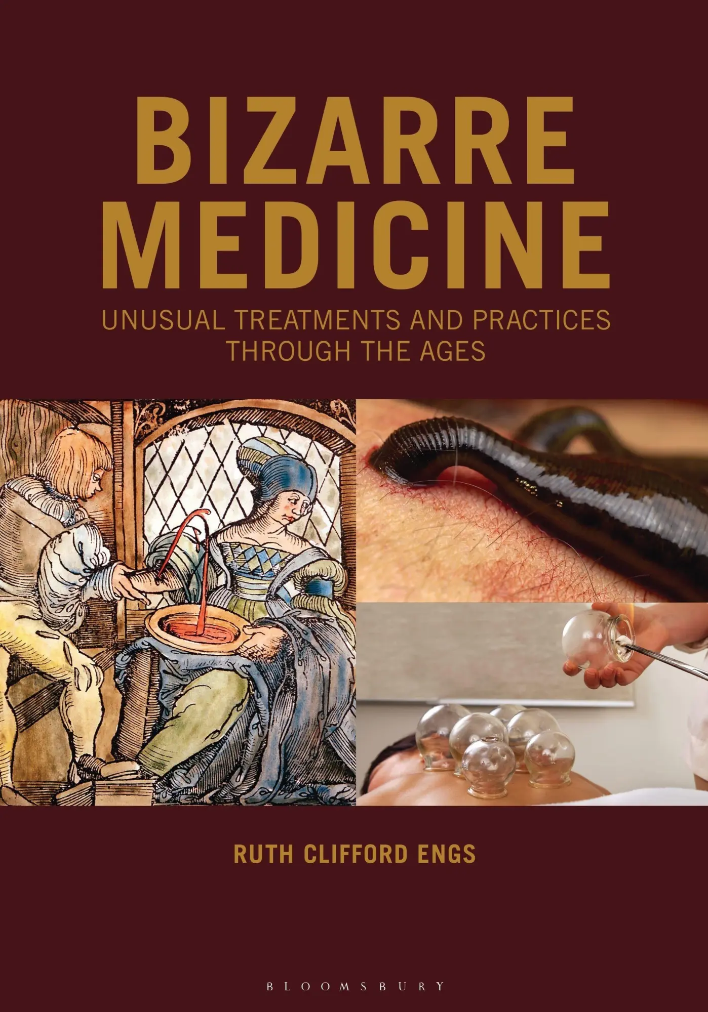Cover: 9798216445562 | Bizarre Medicine | Unusual Treatments and Practices through the Ages