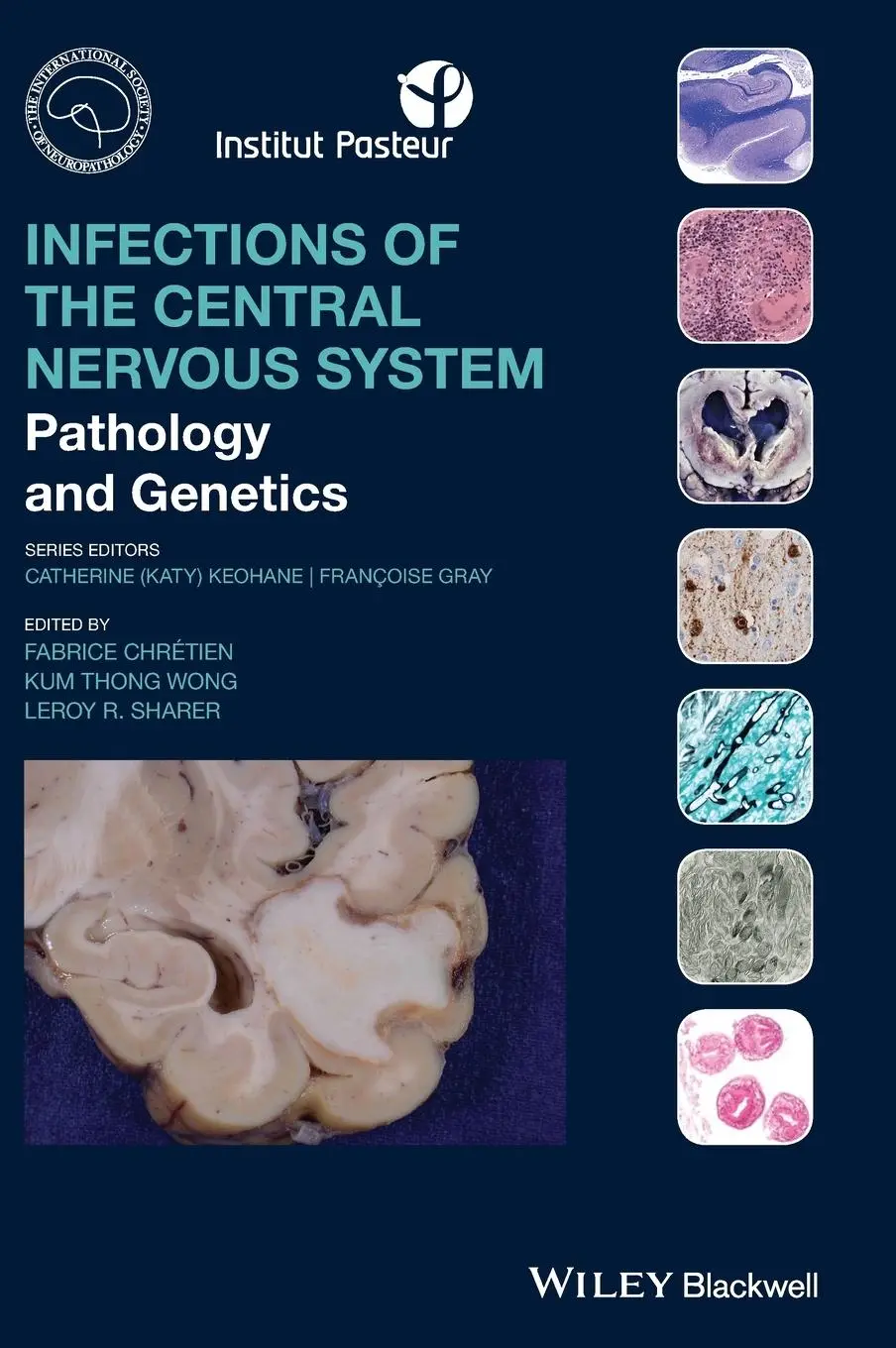 Cover: 9781119467762 | Infections of the Central Nervous System | Fabrice Chretien (u. a.)