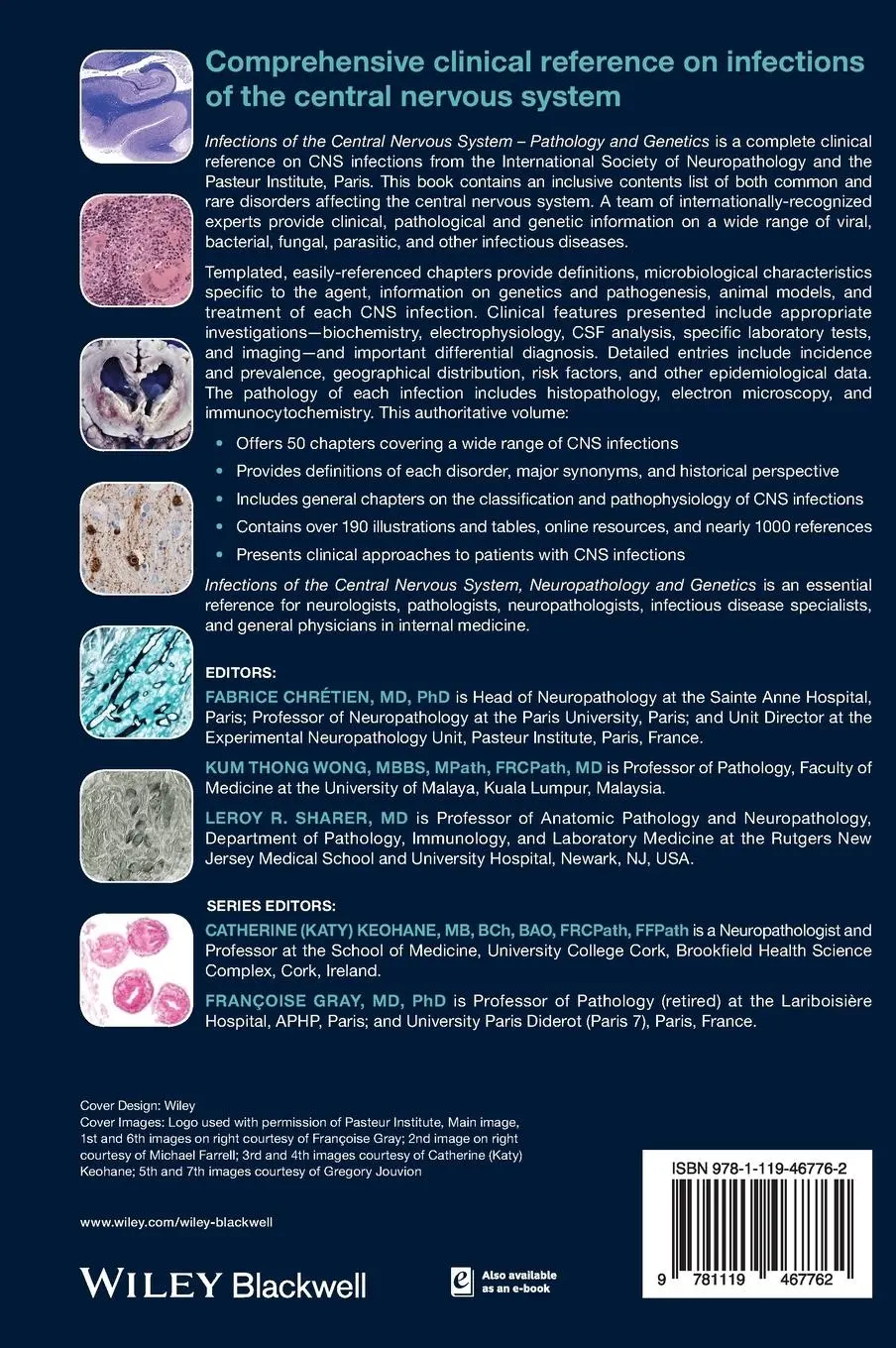 Rückseite: 9781119467762 | Infections of the Central Nervous System | Fabrice Chretien (u. a.)