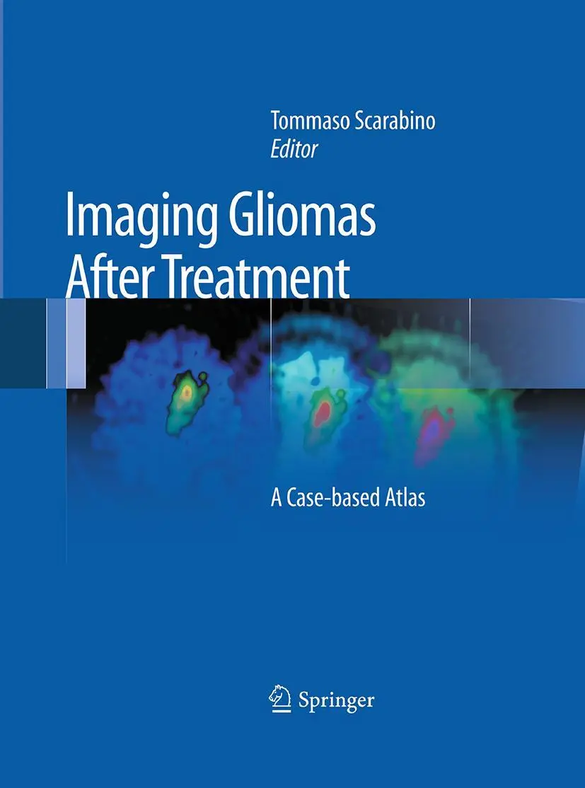 Cover: 9788847058262 | Imaging Gliomas After Treatment | A Case-Based Atlas | Scarabino