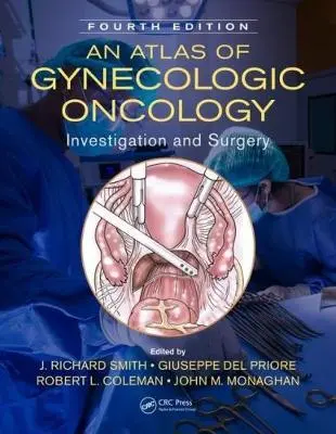 Cover: 9781498729062 | Atlas of Gynecologic Oncology | J. Richard Smith | Buch | Englisch