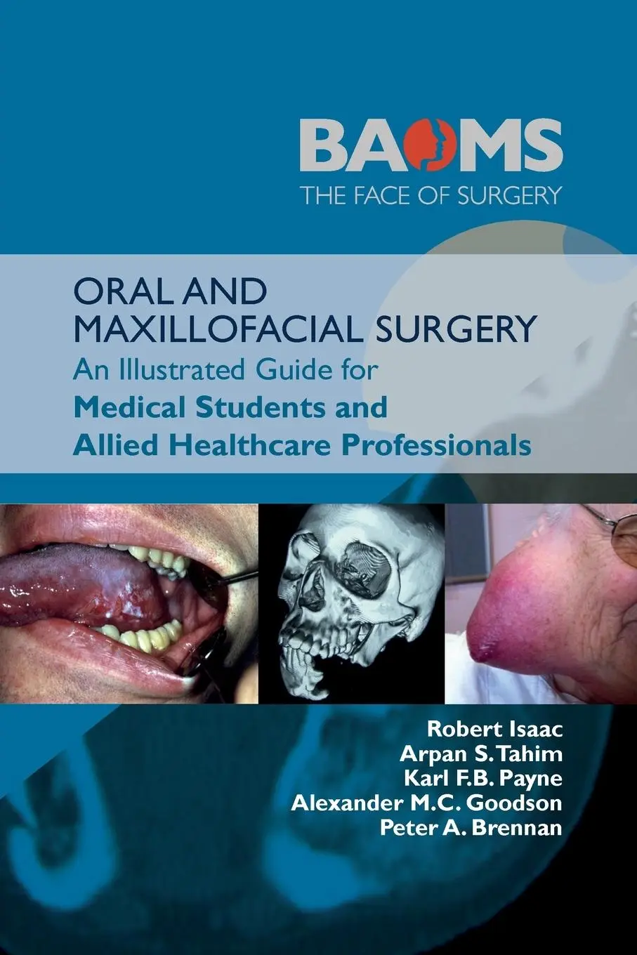 Cover: 9781911450863 | Oral and Maxillofacial Surgery | Robert Isaac (u. a.) | Taschenbuch