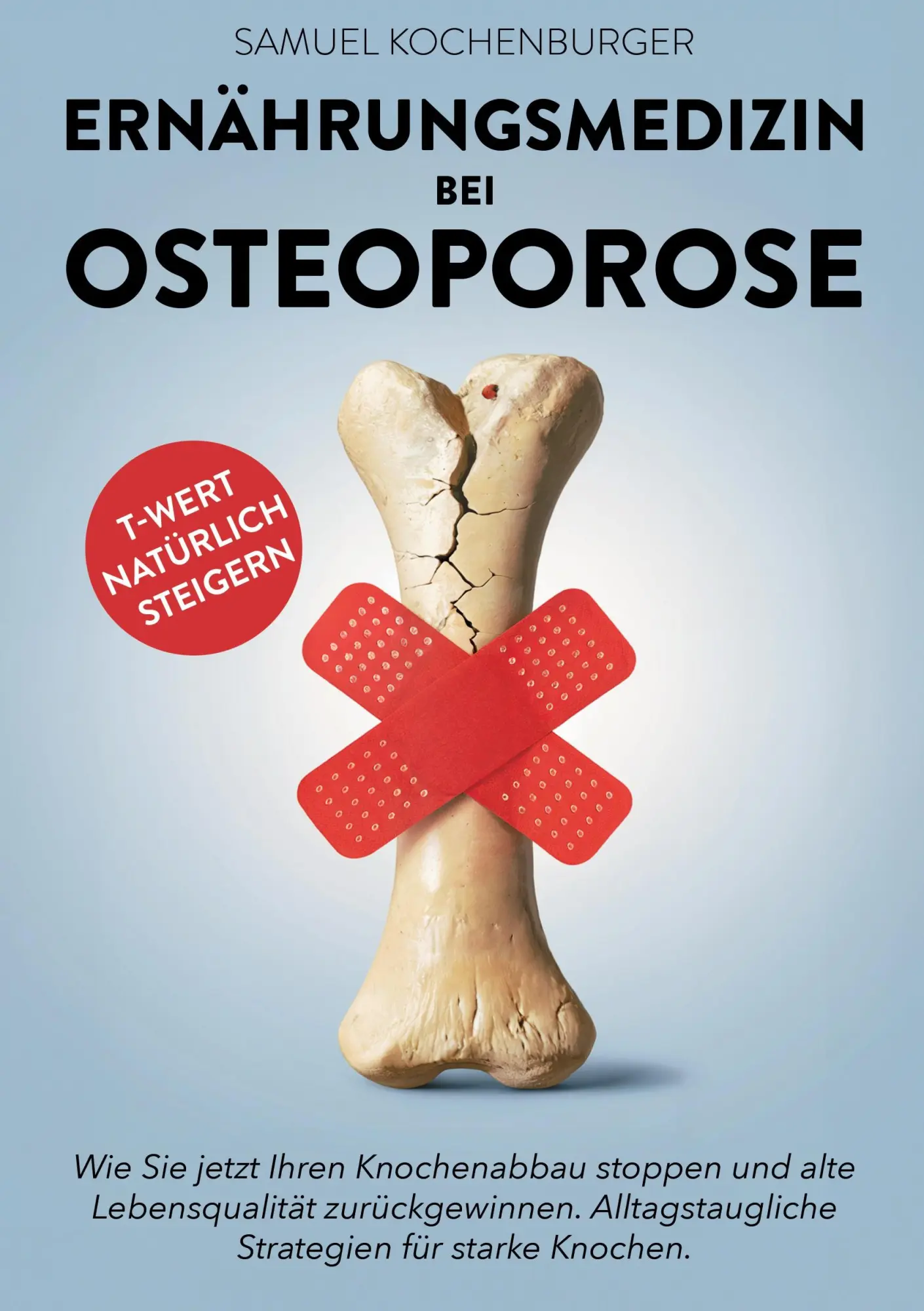 Cover: 9783691041163 | Ernährungsmedizin bei Osteoporose | Samuel Kochenburger | Taschenbuch
