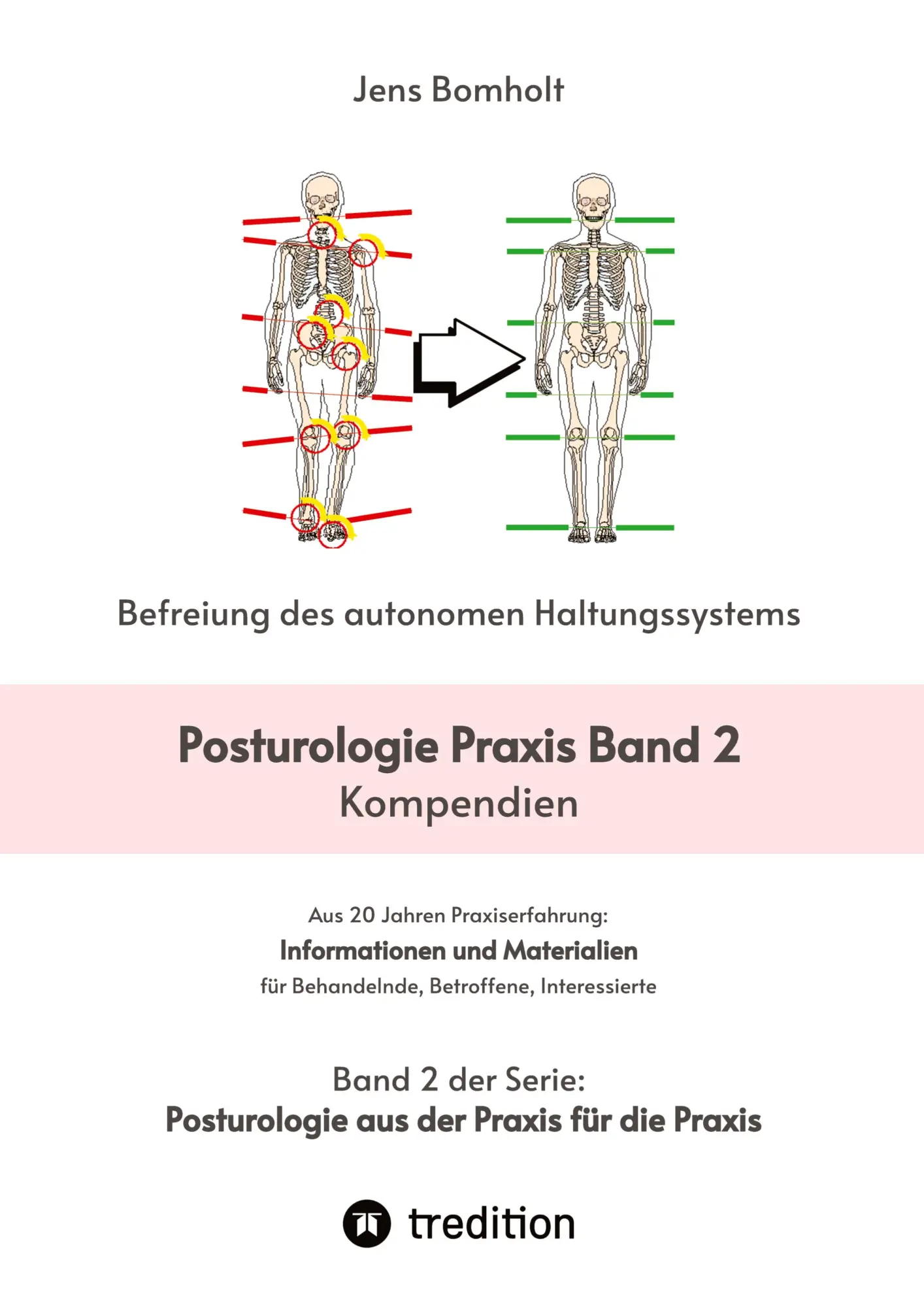 Cover: 9783384411563 | Posturologie Praxis Band 2 | Kompendien | Jens Bomholt | Taschenbuch