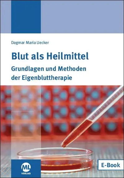 Cover: 9783946746263 | Blut als Heilmittel | Dagmar Maria Uecker | Taschenbuch | 108 S.