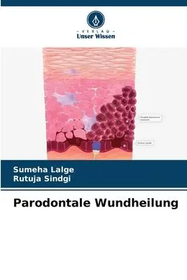 Cover: 9786206306863 | Parodontale Wundheilung | Sumeha Lalge (u. a.) | Taschenbuch | 240 S.