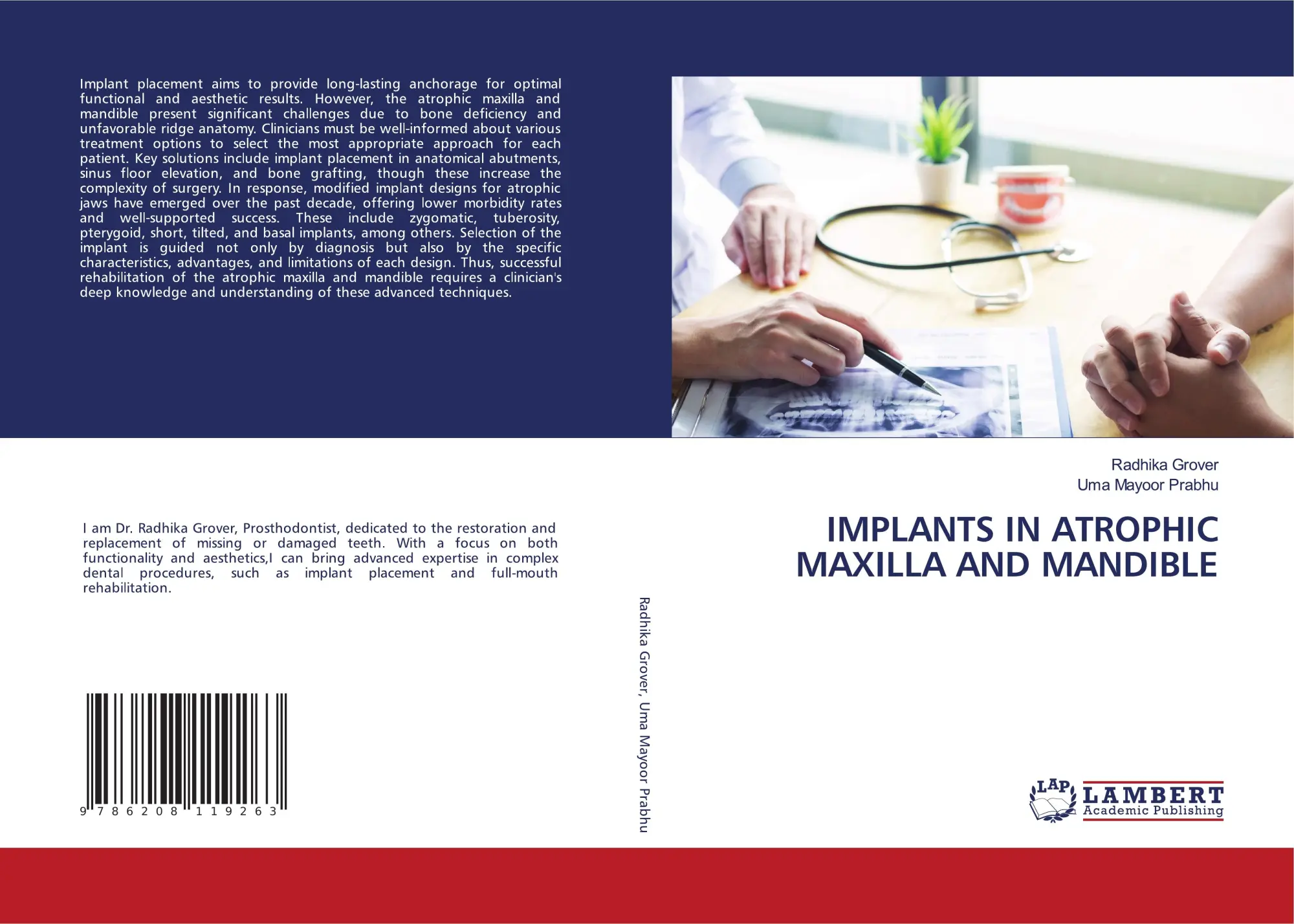 Cover: 9786208119263 | IMPLANTS IN ATROPHIC MAXILLA AND MANDIBLE | Radhika Grover (u. a.)