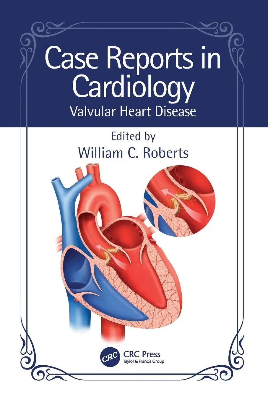 Cover: 9781032529363 | Case Reports in Cardiology | Valvular Heart Disease | Roberts | Buch
