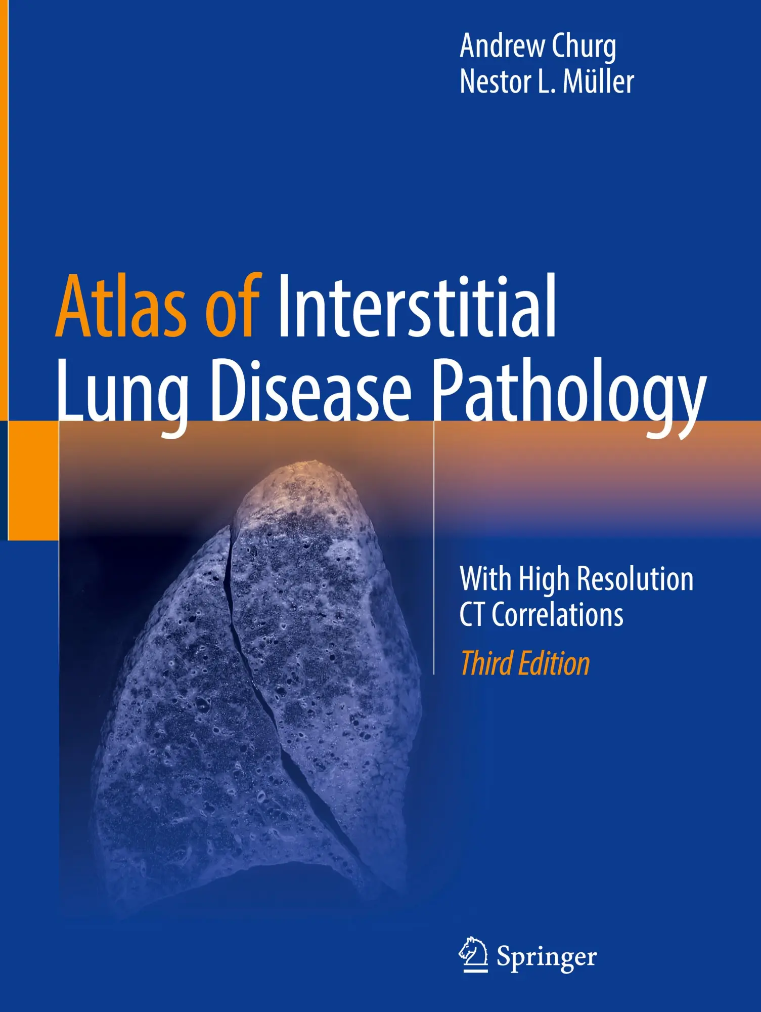 Cover: 9783031859663 | Atlas of Interstitial Lung Disease Pathology | Müller (u. a.) | Buch