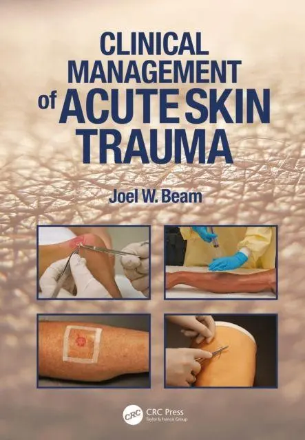 Cover: 9781638220664 | Clinical Management of Acute Skin Trauma | Joel W. Beam | Taschenbuch
