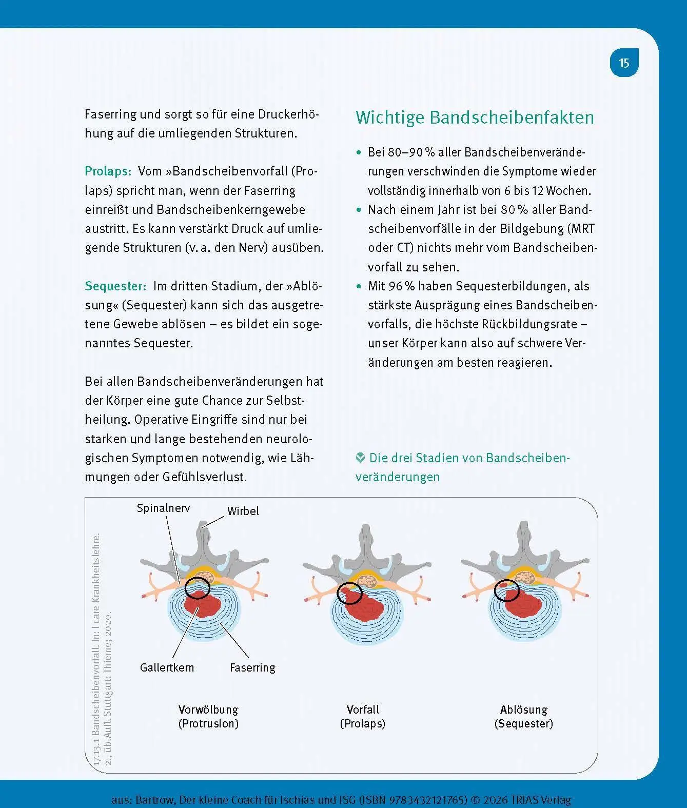 Bild: 9783432121765 | Der kleine Coach für Ischias und ISG | Kay Bartrow | Taschenbuch