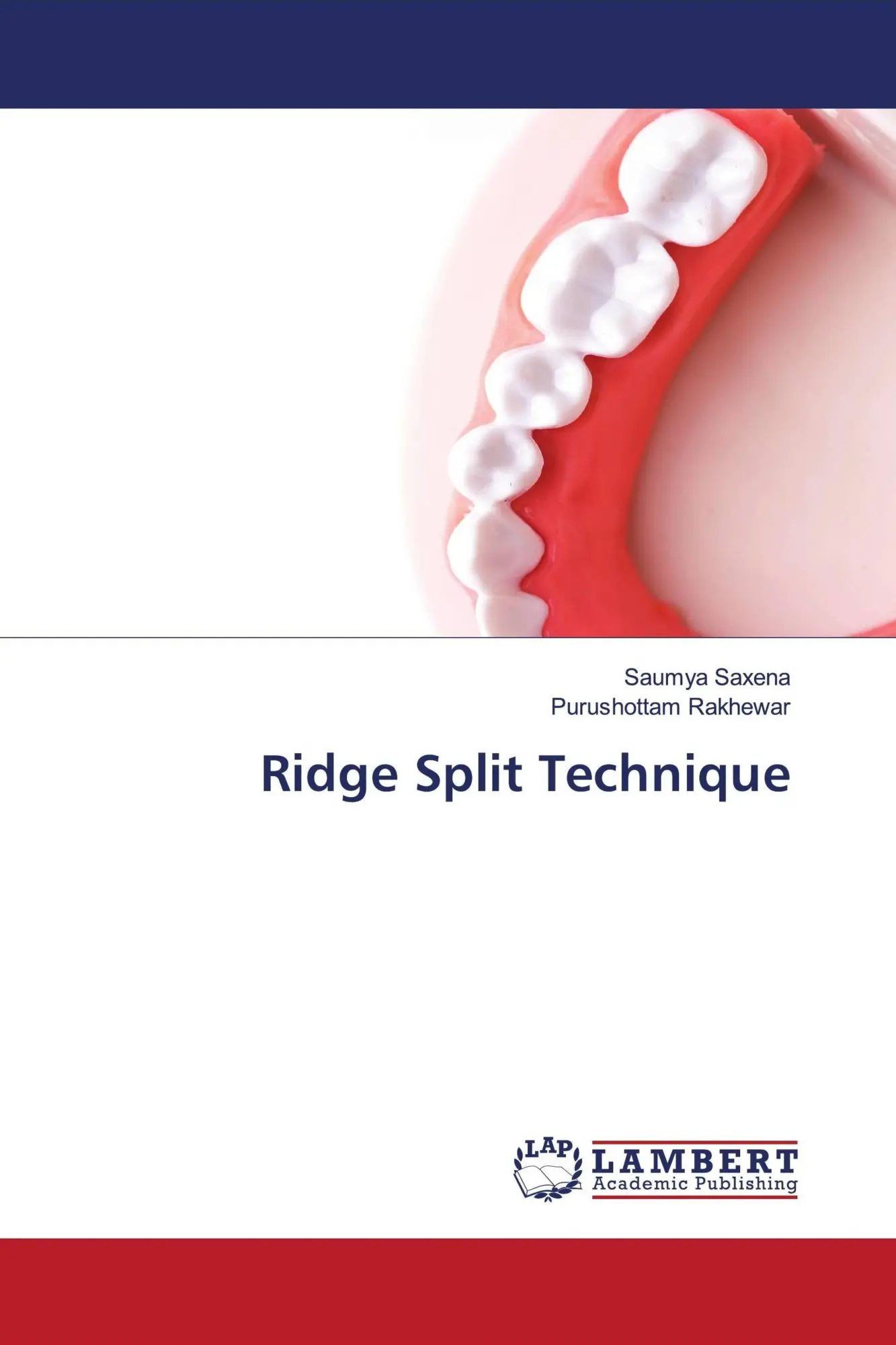 Cover: 9786202522465 | Ridge Split Technique | Saumya Saxena (u. a.) | Taschenbuch | Englisch