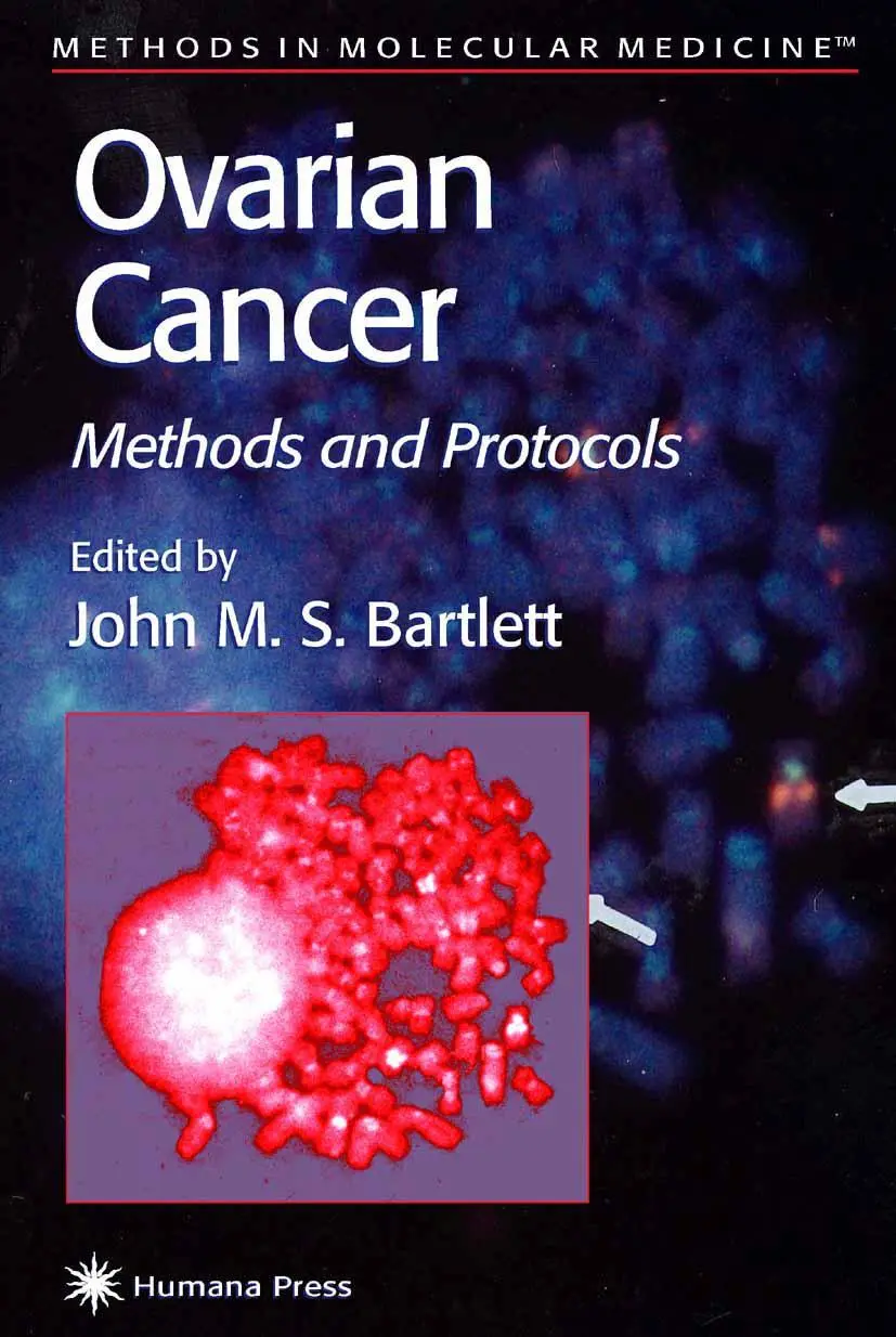 Cover: 9781489943965 | Ovarian Cancer | Methods and Protocols | John M. S. Bartlett | Buch