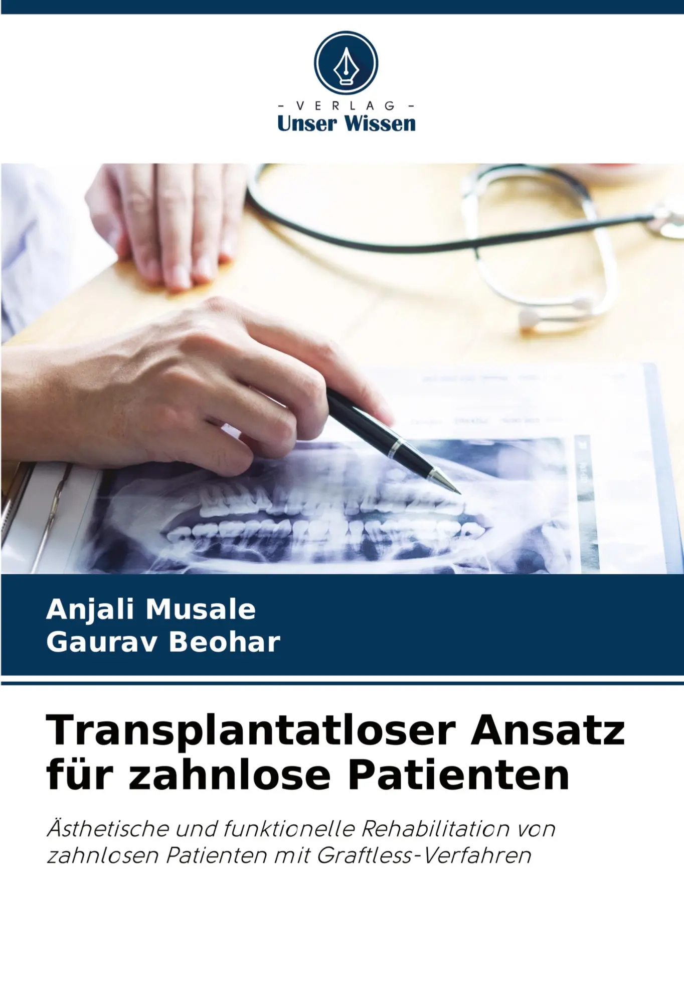 Cover: 9786208570866 | Transplantatloser Ansatz für zahnlose Patienten | Musale (u. a.)