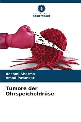 Cover: 9786205671566 | Tumore der Ohrspeicheldrüse | Reshmi Sharma (u. a.) | Taschenbuch