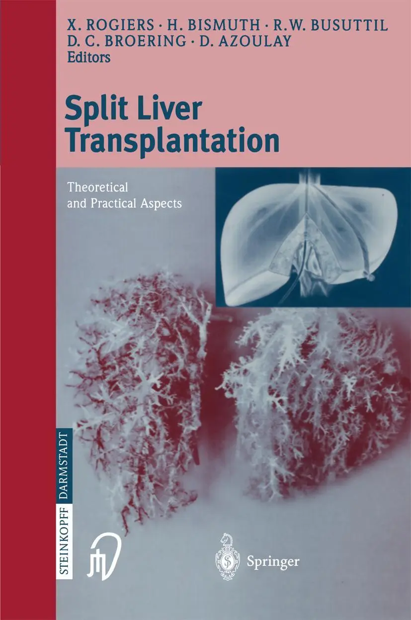 Cover: 9783798512566 | Split liver transplantation | Theoretical and practical aspects | Buch
