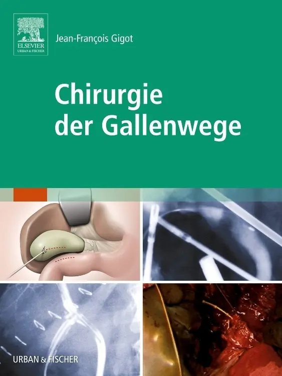 Cover: 9783437313066 | Chirurgie der Gallenwege | Jean-François Gigot | Taschenbuch | XVI