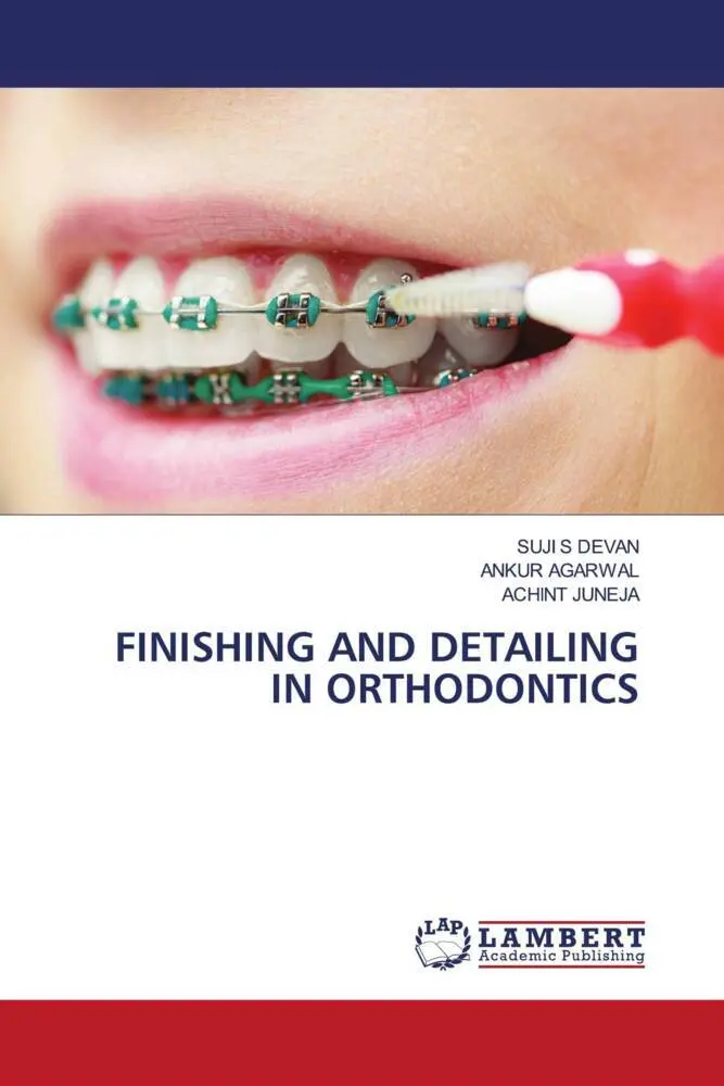 Cover: 9786205633366 | FINISHING AND DETAILING IN ORTHODONTICS | Suji S Devan (u. a.) | Buch