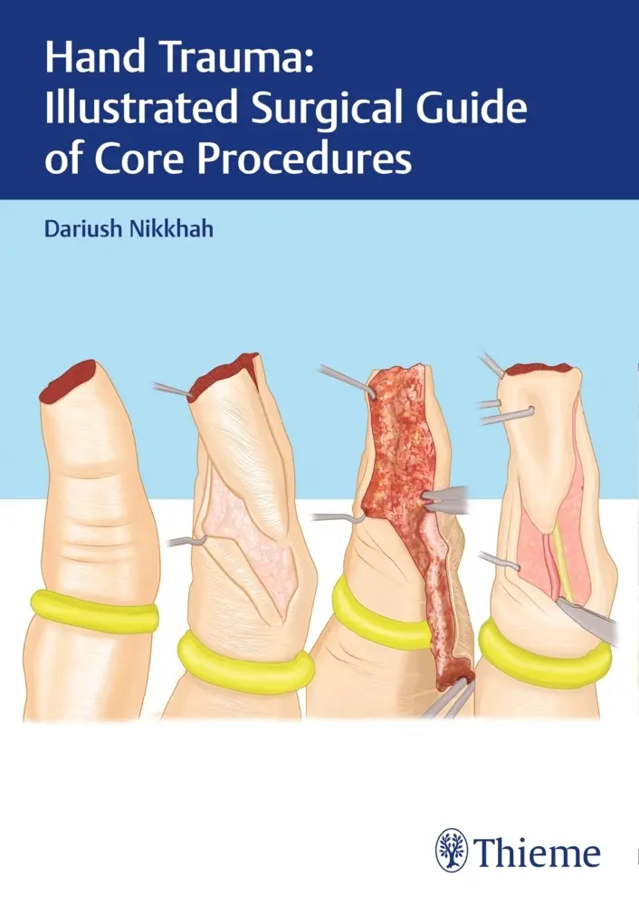 Cover: 9783132414266 | Hand Trauma: Illustrated Surgical Guide of Core Procedures | Nikkhah