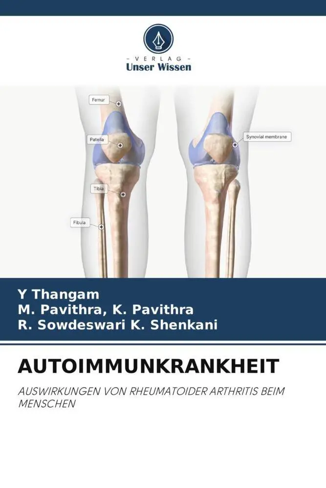 Cover: 9786205896266 | AUTOIMMUNKRANKHEIT | Y. Thangam (u. a.) | Taschenbuch | Paperback