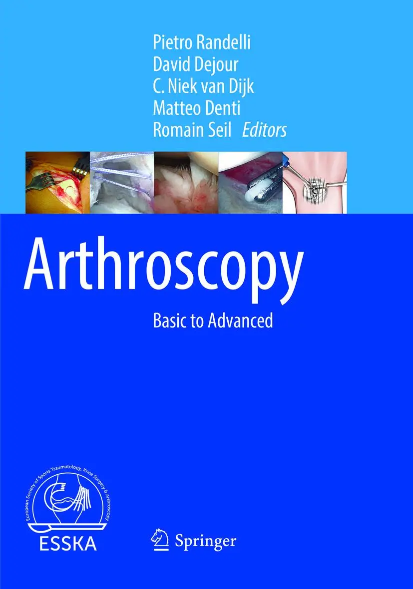 Cover: 9783662570067 | Arthroscopy | Basic to Advanced | David Dejour (u. a.) | Taschenbuch