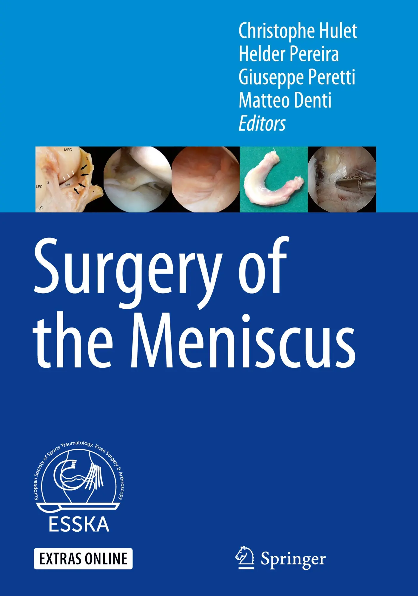 Cover: 9783662491867 | Surgery of the Meniscus | Christophe Hulet (u. a.) | Buch | xv | 2016