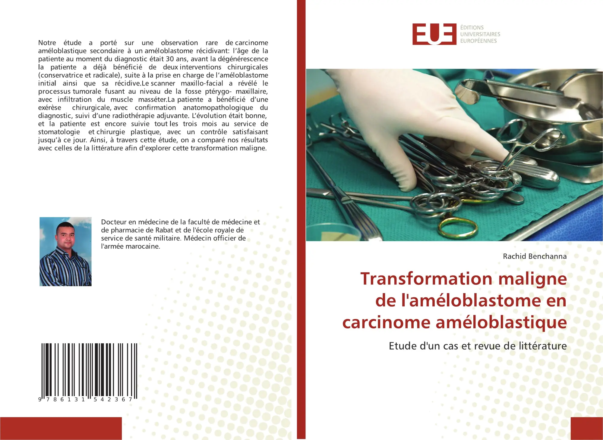 Transformation maligne de l'améloblastome en carcinome améloblastique