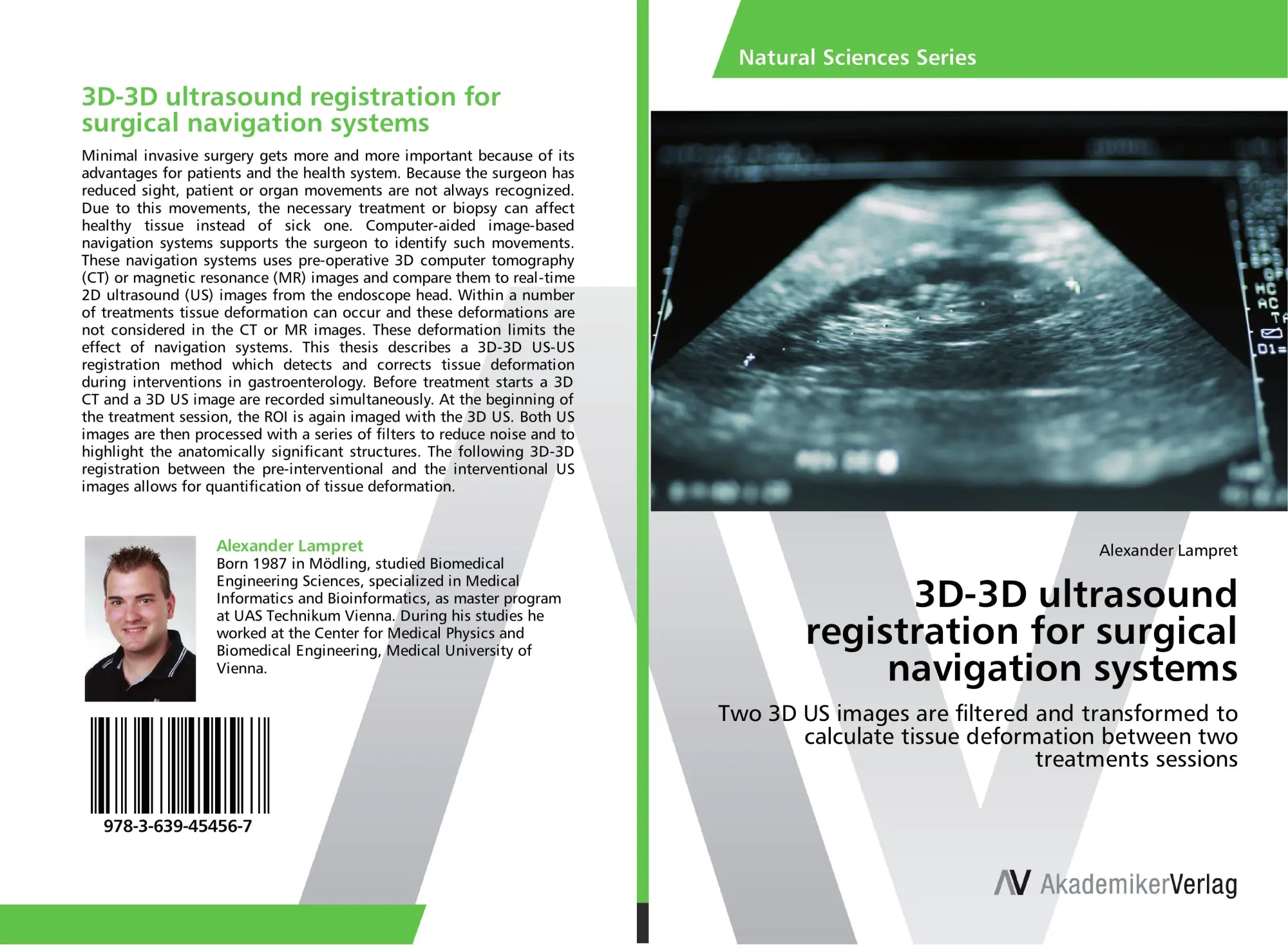 Cover: 9783639454567 | 3D-3D ultrasound registration for surgical navigation systems | Buch