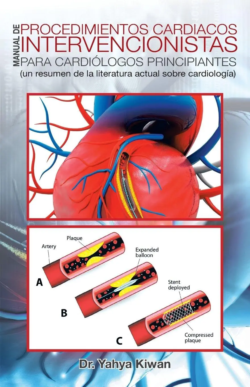 Cover: 9781482879667 | Manual de procedimientos cardiacos intervencionistas para...