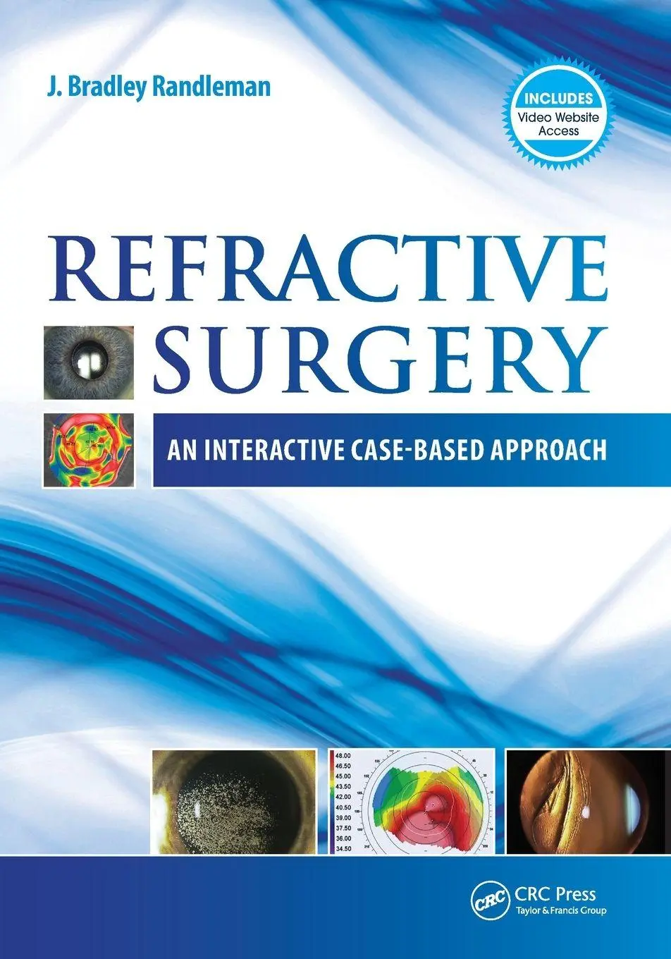 Cover: 9781617110368 | Refractive Surgery | An Interactive Case-Based Approach | Randleman