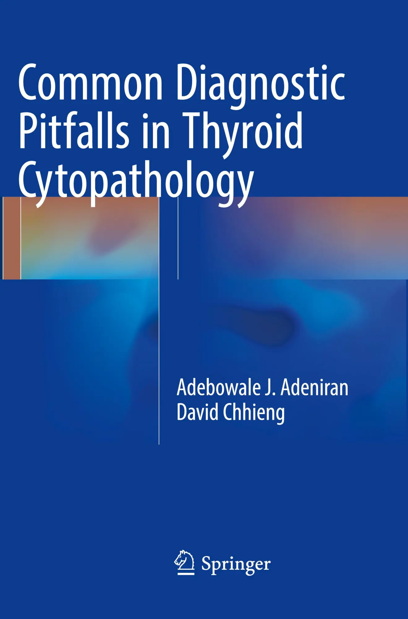 Cover: 9783319810768 | Common Diagnostic Pitfalls in Thyroid Cytopathology | Adeniran (u. a.)