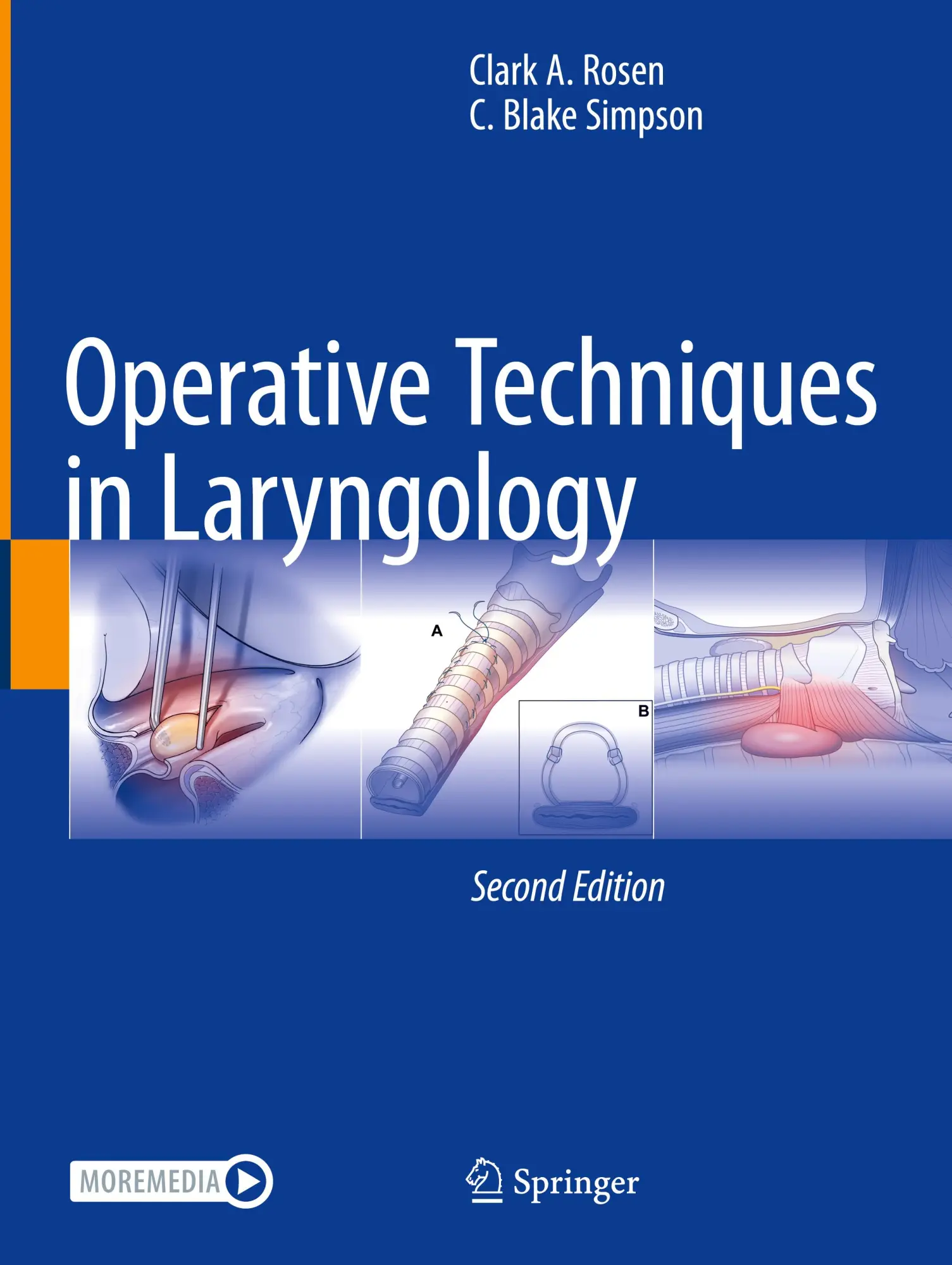 Cover: 9783031343568 | Operative Techniques in Laryngology | C. Blake Simpson (u. a.) | Buch