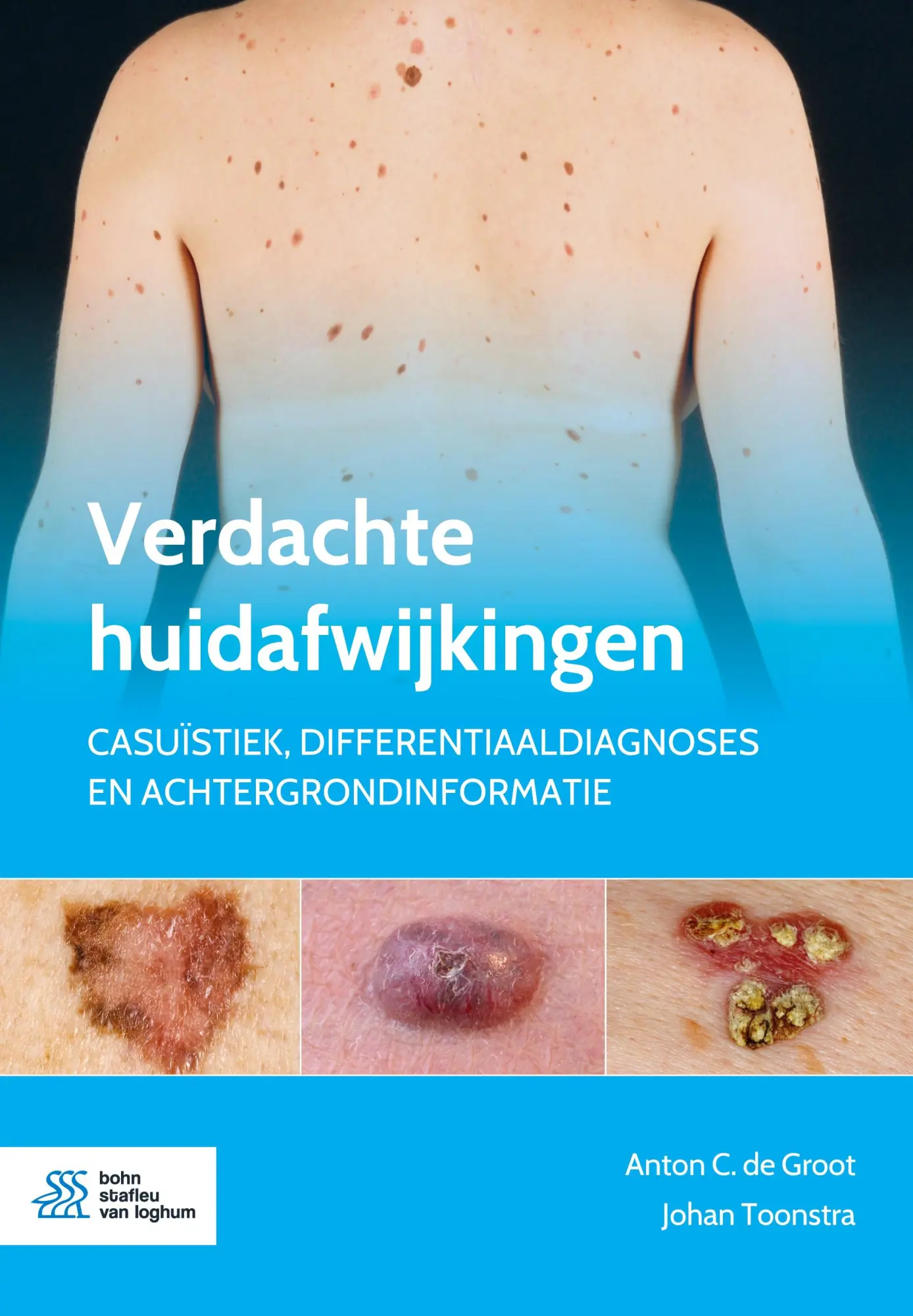 Cover: 9789036824668 | Verdachte huidafwijkingen | Johan Toonstra (u. a.) | Taschenbuch