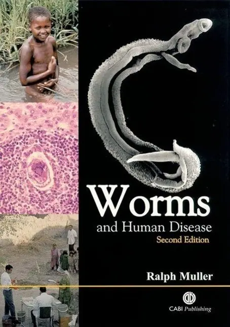 Cover: 9780851995168 | Worms and Human Disease | Cabi | Taschenbuch | Englisch | 2001 | Cabi