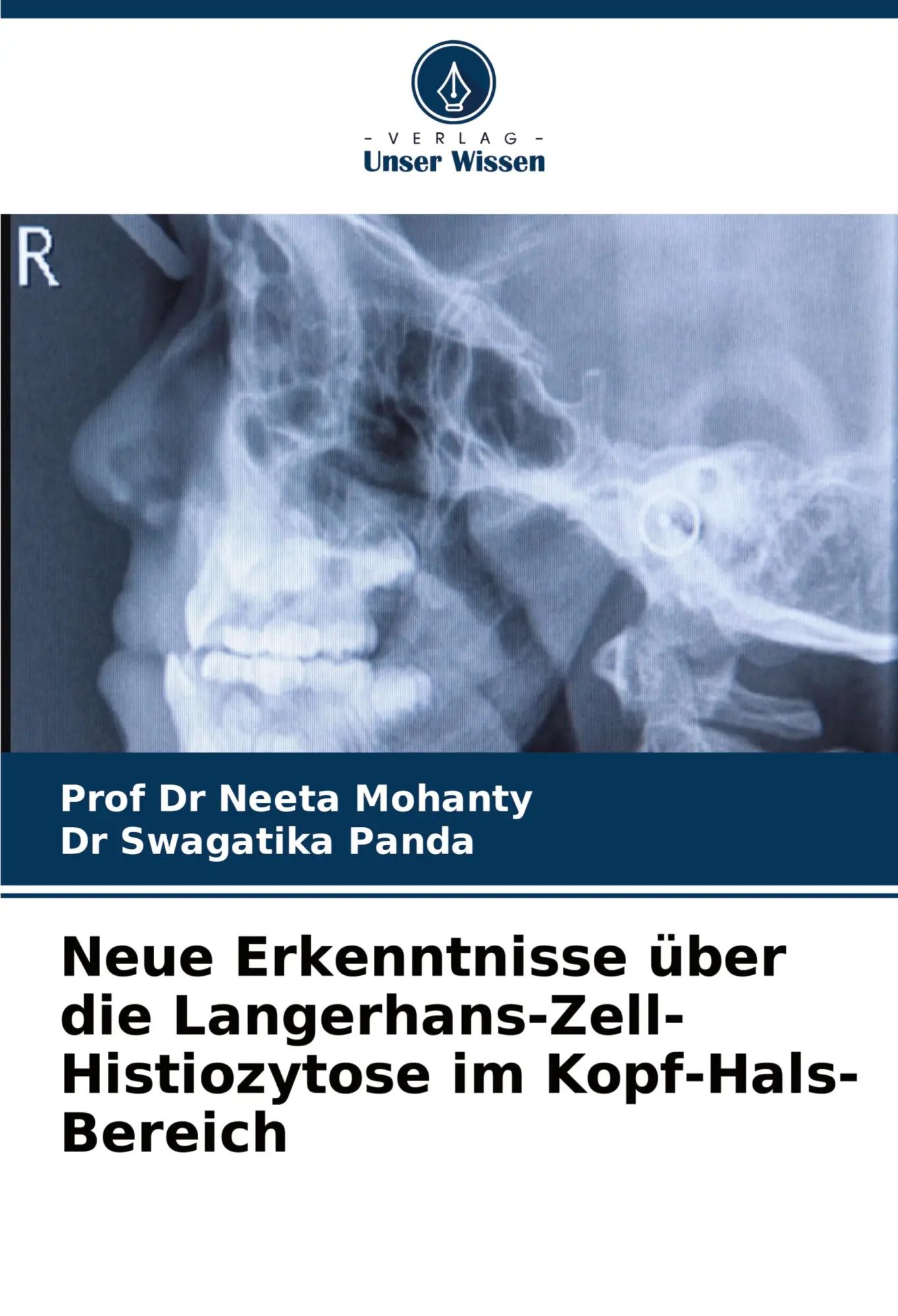 Cover: 9786208326968 | Neue Erkenntnisse über die Langerhans-Zell-Histiozytose im...