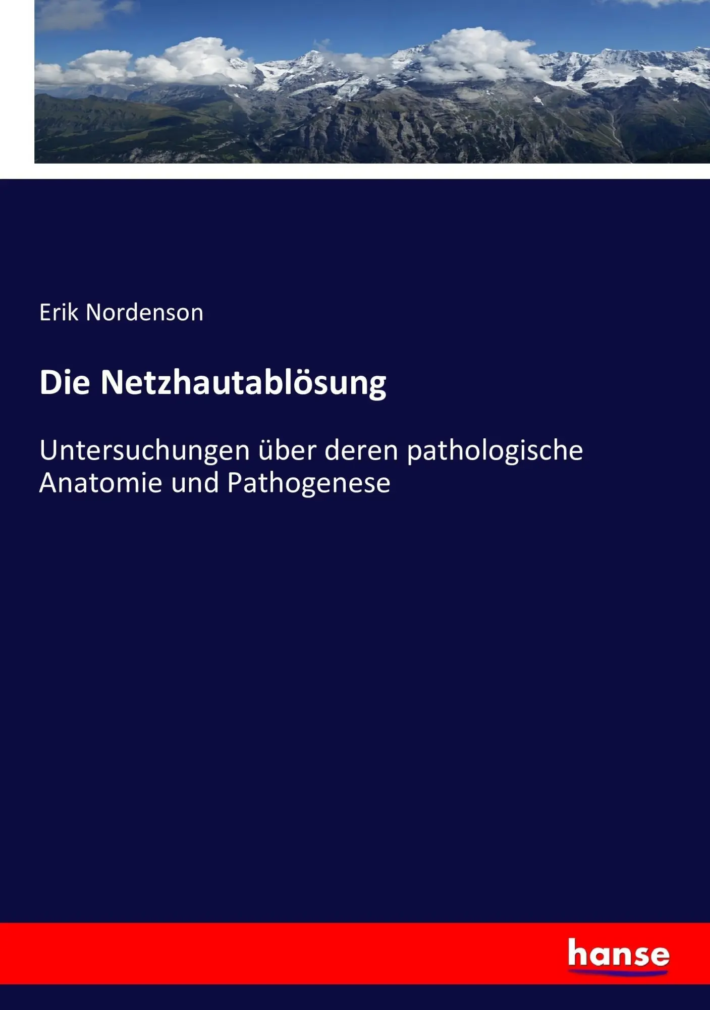 Cover: 9783743371569 | Die Netzhautablösung | Erik Nordenson | Taschenbuch | 376 S. | Deutsch