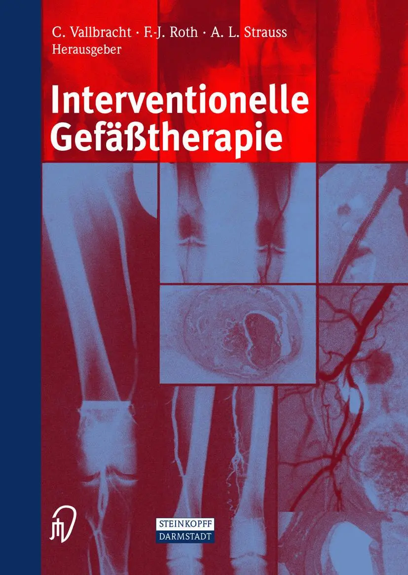 Cover: 9783642632969 | Interventionelle Gefäßtherapie | C. Vallbracht (u. a.) | Taschenbuch