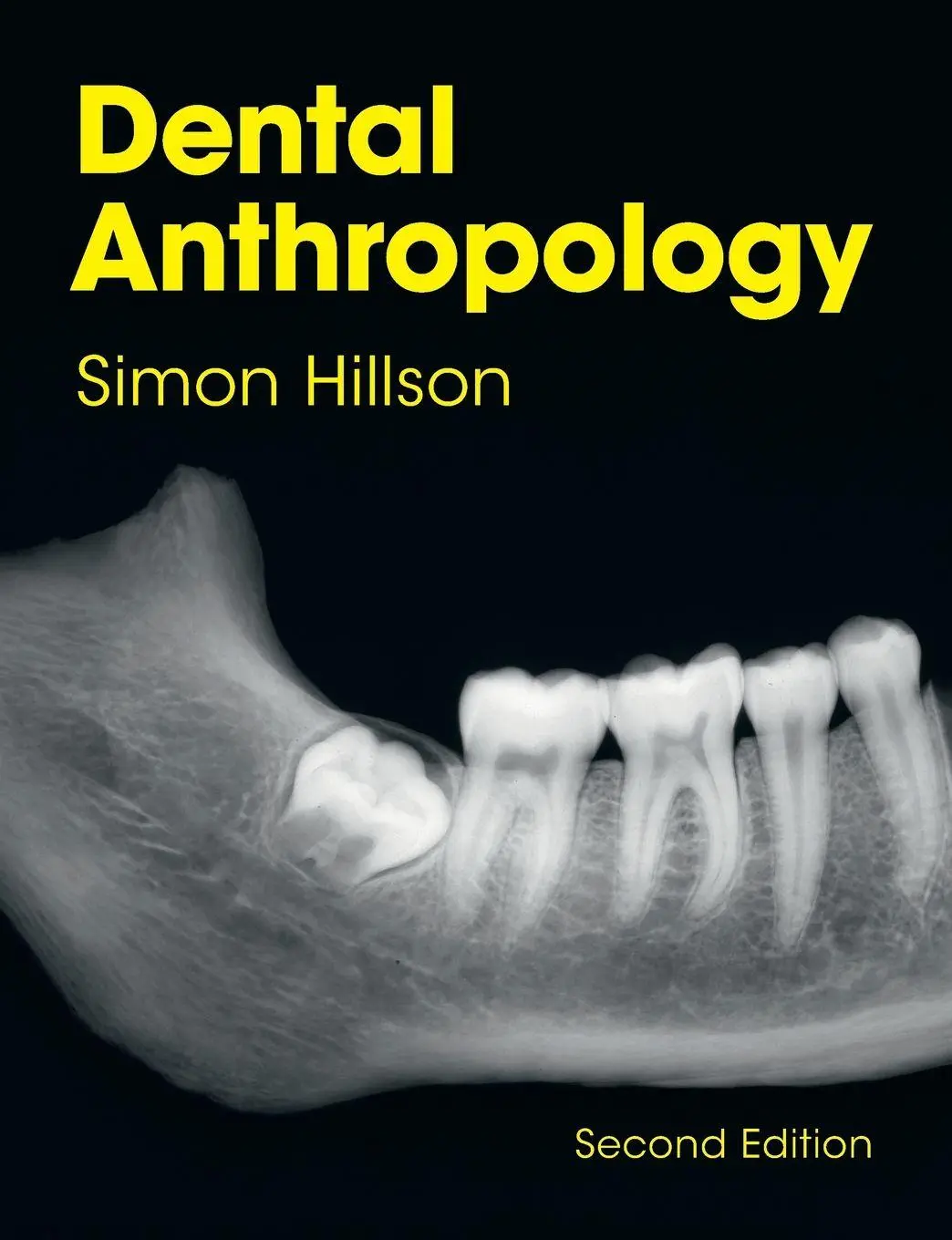 Cover: 9781108433969 | Dental Anthropology | Simon Hillson | Taschenbuch | Englisch | 2023